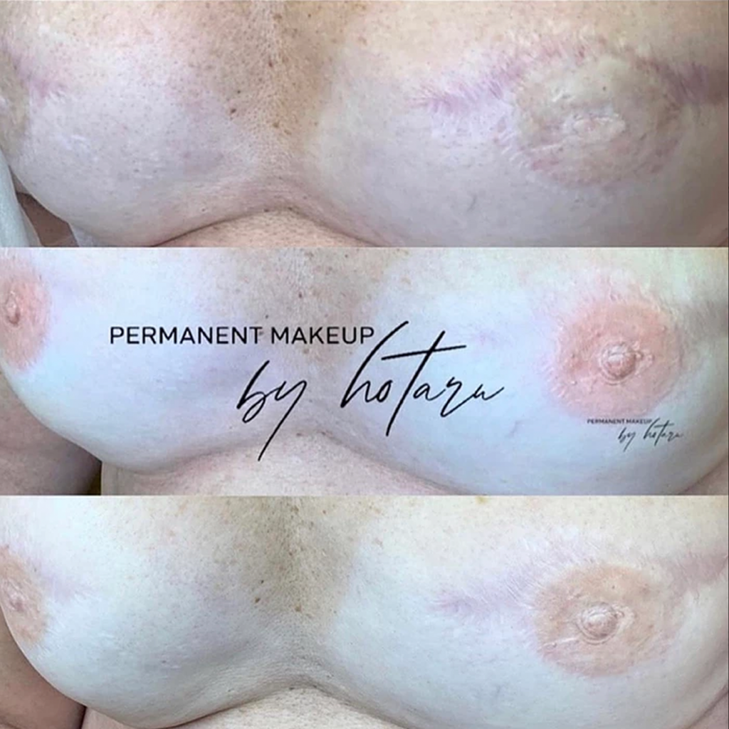 Paramedical areola tattoo, louisville